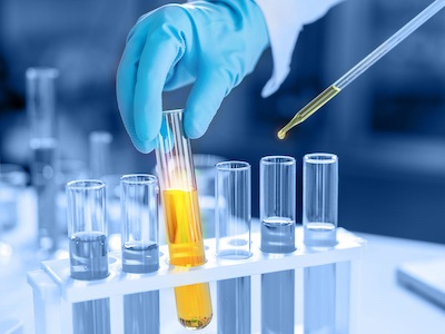 Medical research performed in a Life Science lab